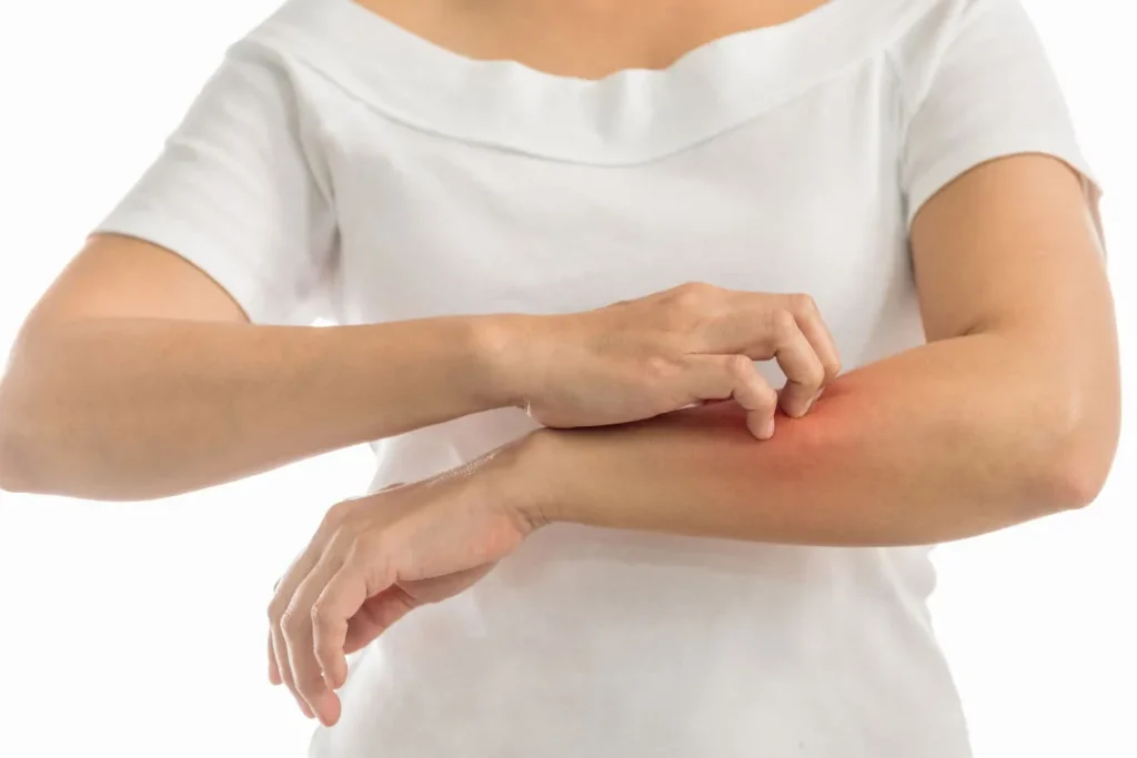 Stops of itching.