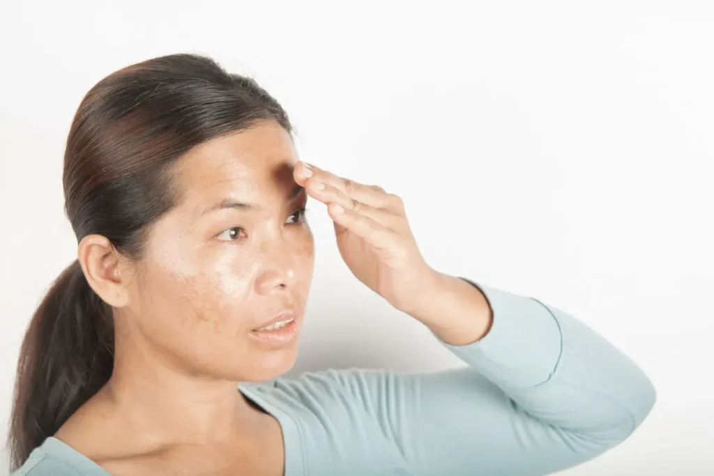A lady having damaged skin.