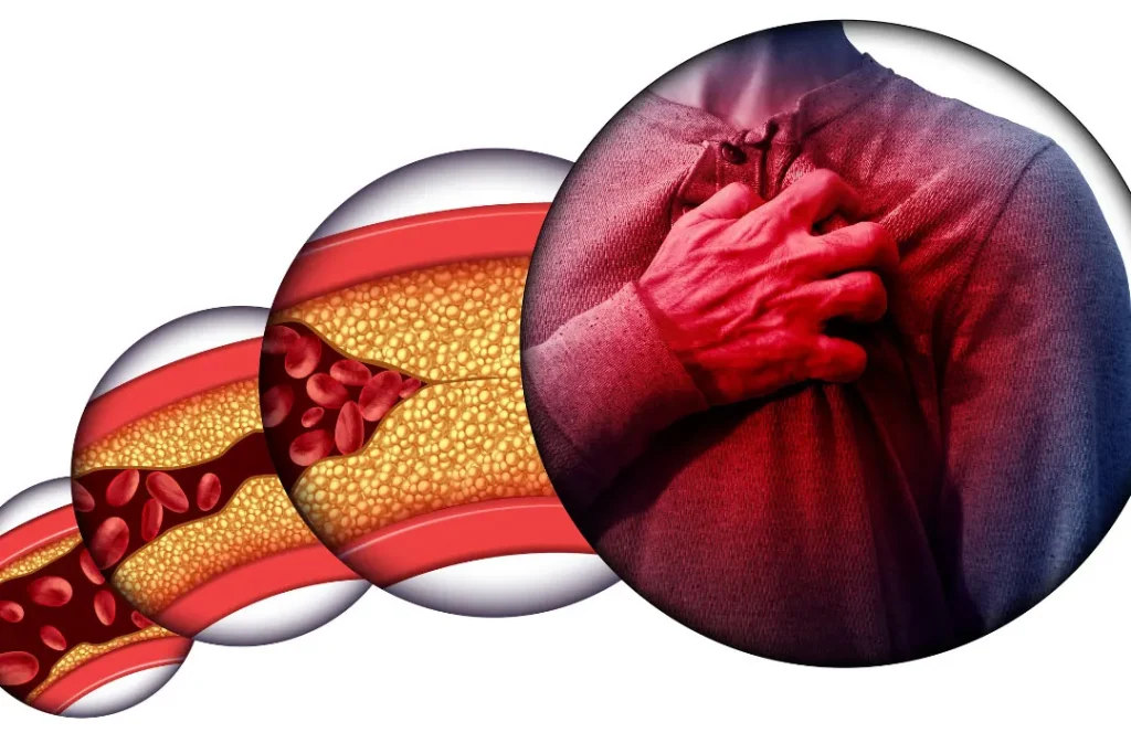 concept of heart disease
