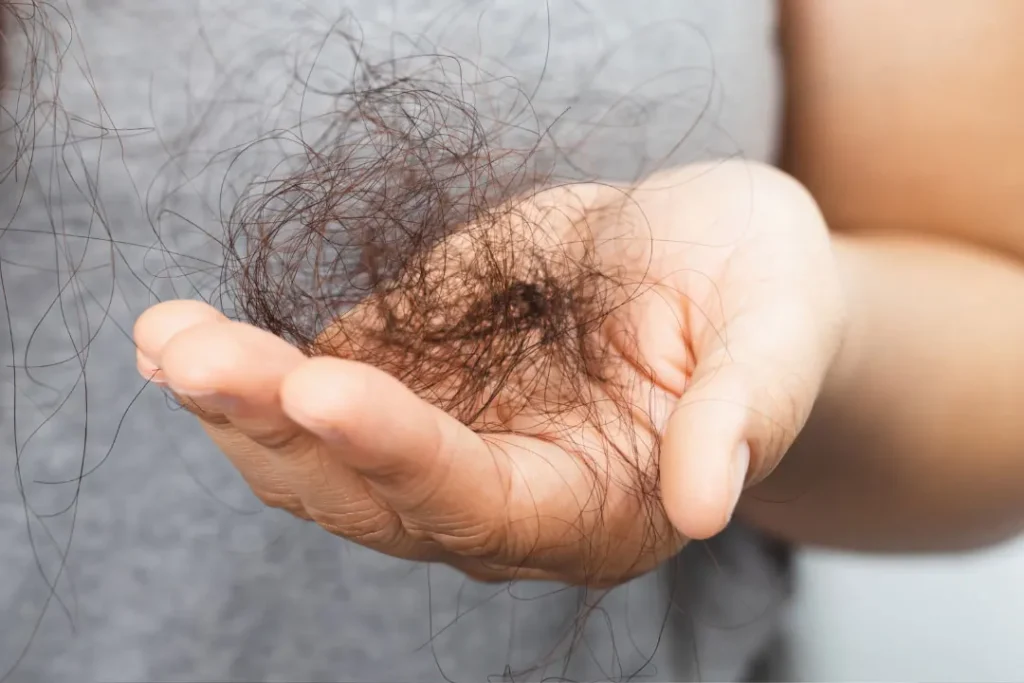 Hair loss.