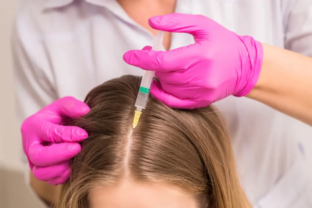 Stem cell treatment for thin hair.
