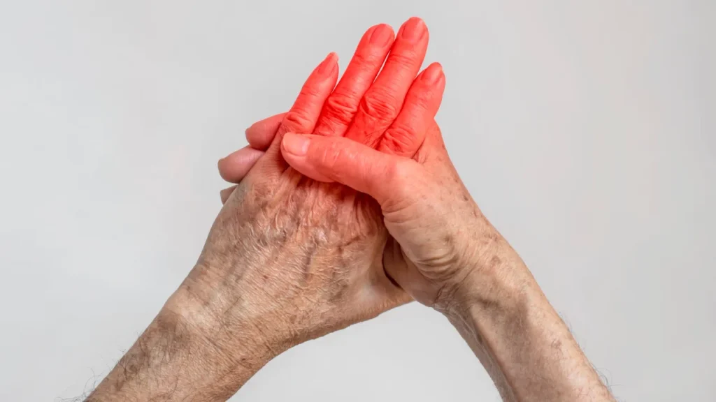 Arthritis issue.