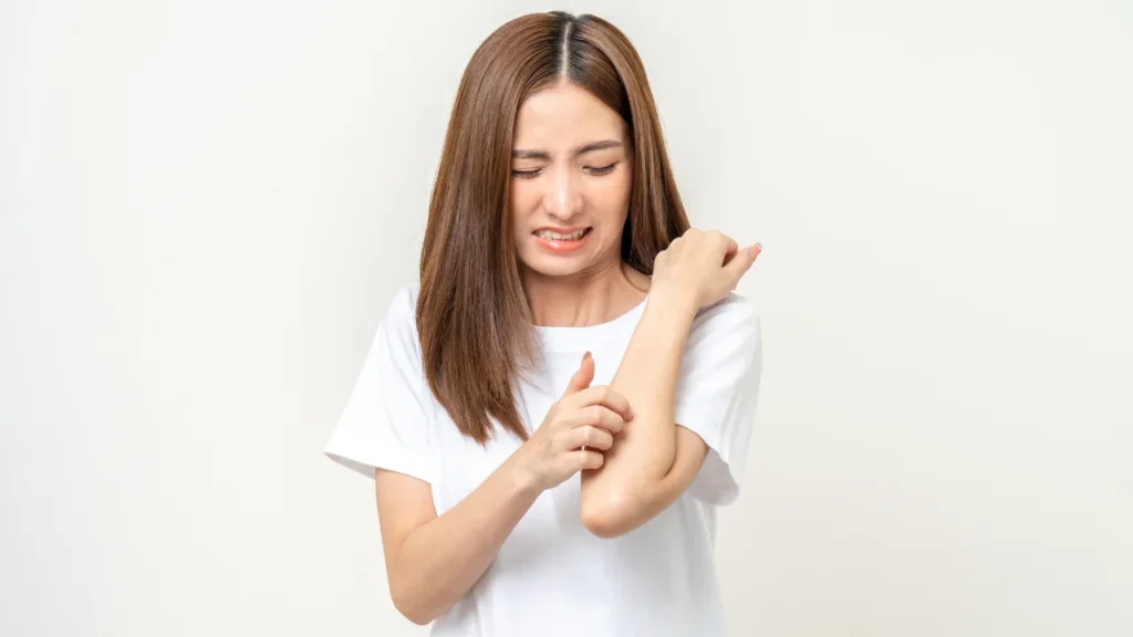 Lady having skin allergy.