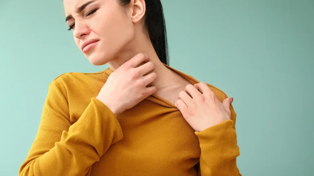 Lady facing skin allergy.
