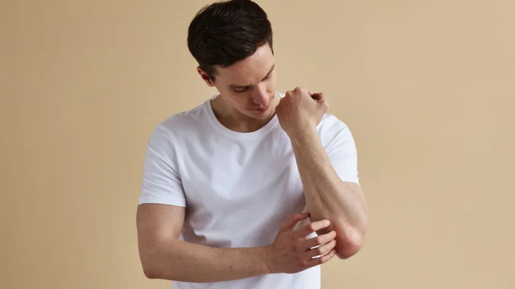 Man having skin allergy.