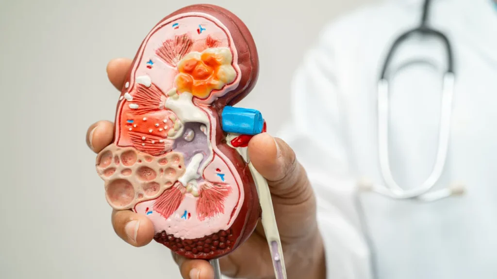 Kidney issue.