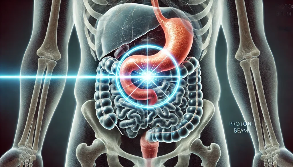 Detailed medical illustration of a proton beam precisely targeting a tumor in the pancreas, bypassing surrounding organs to minimize damage to healthy tissues.