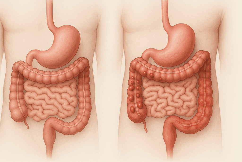 Digestive system images comparing healthy organs to those with colon polyps, inflammation, and early disease signs