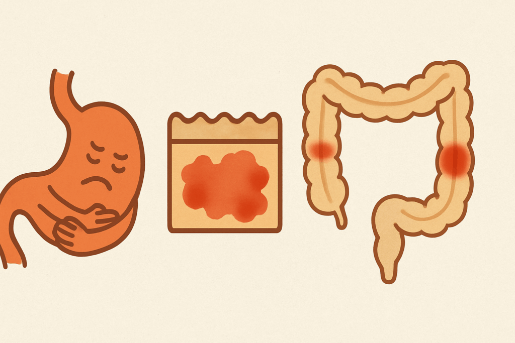 Clutching stomach, inflamed intestinal lining, segmented digestive tract icons illustrating the Meaning of Digestion.